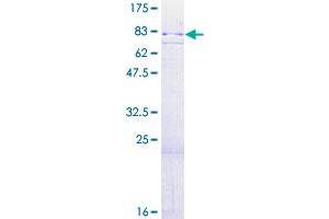 Image no. 1 for Ribosomal Protein S6 Kinase A4 (RPS6KA4) (AA 1-524) protein (GST tag) (ABIN1318829)