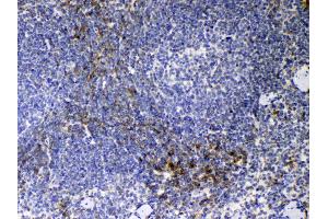 IHC analysis of CD14 using anti-CD14 antibody .