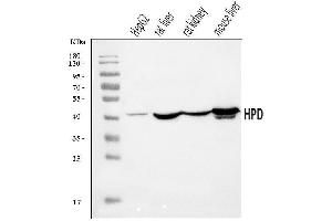 Western blot analysis of HPD using anti-HPD antibody (ABIN7599818).