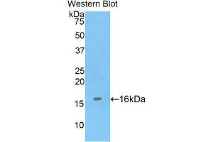 Western Blotting (WB) image for anti-ADAM Metallopeptidase with Thrombospondin Type 1 Motif, 7 (ADAMTS7) (AA 226-437) antibody (ABIN1857907)