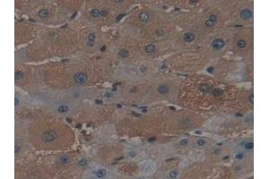 Detection of FTH in Human Liver Tissue using Polyclonal Antibody to Ferritin, Heavy Polypeptide (FTH)