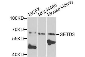 Western blot analysis of extracts of various cells, using SETD3 antibody. (SETD3 anticorps)
