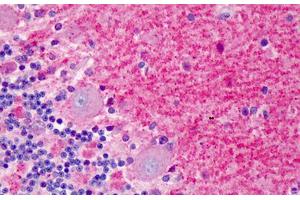 Human Brain, Cerebellum: Formalin-Fixed, Paraffin-Embedded (FFPE)