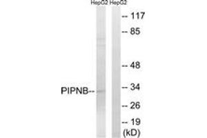 Western blot analysis of extracts from HepG2 cells, using PITPNB Antibody. (PITPNB anticorps  (AA 20-69))