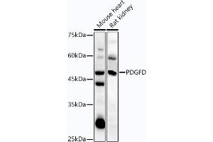 Western blot analysis of extracts of various cell lines, using PDGFD antibody (ABIN7269393) at 1:1000 dilution. (PDGFD anticorps  (AA 185-364))