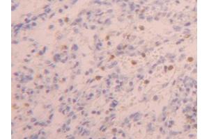 DAB staining on IHC-P; Samples: Human Spleen Tissue (ZYX anticorps  (AA 384-572))