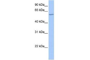 DNTT antibody used at 1 ug/ml to detect target protein. (TdT anticorps  (N-Term))