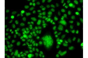 Immunofluorescence analysis of A549 cells using PPAN antibody (ABIN5975126). (PPAN anticorps)