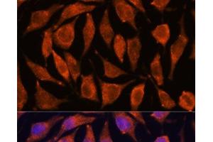 Immunofluorescence analysis of L929 cells using TNFAIP8L2 Polyclonal Antibody at dilution of 1:100. (TNFAIP8L2 anticorps)