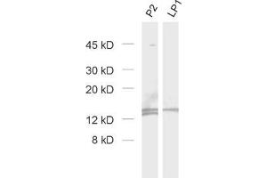 Western Blotting (WB) image for anti-Cornichon Homolog 3 (CNIH3) (AA 128-140), (Isoform 1) antibody (ABIN1742511) (CNIH3 anticorps  (Isoform 1))
