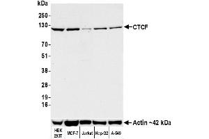 Western Blotting (WB) image for anti-CCCTC-Binding Factor (Zinc Finger Protein) (CTCF) (AA 650-700) antibody (ABIN7453967) (Recombinant CTCF anticorps  (AA 650-700))