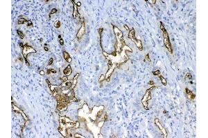 IHC analysis of MUC1 using anti-MUC1 antibody .