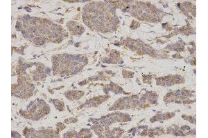 Immunohistochemistry (IHC) image for anti-GDP Dissociation Inhibitor 1 (GDI1) antibody (ABIN1876650) (GDI1 anticorps)