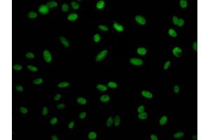 Immunofluorescence staining of Hela Cells with ABIN7127789 at 1:50, counter-stained with DAPI. (Recombinant Retinoblastoma Binding Protein 4 anticorps)