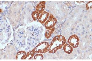 Immunohistochemistry of paraffin-embedded Rat kidney using PDGFR beta Polyclonal Antibody at dilution of 1:100 (40x lens). (PDGFRB anticorps)