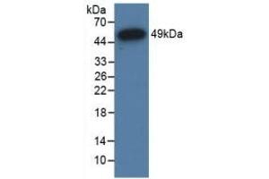 Detection of Recombinant GR, Human using Polyclonal Antibody to Glucocorticoid Receptor (GR) (Glucocorticoid Receptor anticorps  (AA 598-755))