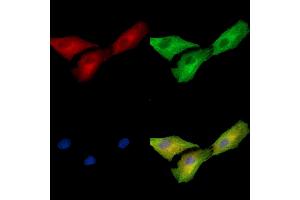 ABIN7096932 and ABIN7100998 staining  cells by IF/ICC.