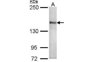 WB Image Sample (30 ug of whole cell lysate) A: 293T 5% SDS PAGE antibody diluted at 1:1000