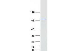 Validation with Western Blot