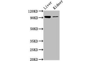 Western Blot Positive WB detected in: Mouse liver tissue, Mouse kidney tissue All lanes: DMGDH antibody at 6. (DMGDH anticorps  (AA 429-524))