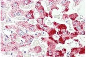 Anti-SCP2 antibody IHC staining of human liver. (SCP2 anticorps  (AA 163-175))