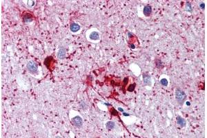 Brain, cortex, Human: Formalin-Fixed, Paraffin-Embedded (FFPE) (DDX58 anticorps)