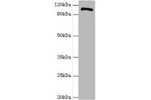 Western blot All lanes: HIP1 antibody at 4 μg/mL + A549 whole cell lysate Secondary Goat polyclonal to rabbit IgG at 1/10000 dilution Predicted band size: 117, 111, 114 kDa Observed band size: 117 kDa (HIP1 anticorps  (AA 410-690))