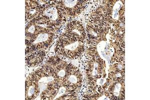 IHC analysis of SNF2H/SMARCA5 using anti-SNF2H/SMARCA5 antibody (ABIN7602001).