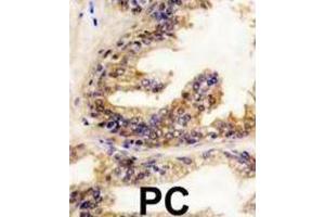 Immunohistochemistry (IHC) image for anti-Small Nuclear Ribonucleoprotein Polypeptide E (SNRPE) antibody (ABIN3003507)