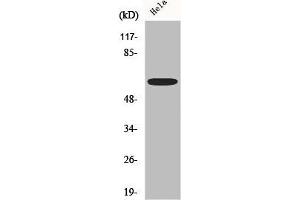 Western Blot analysis of Hela cells using AATF Polyclonal Antibody
