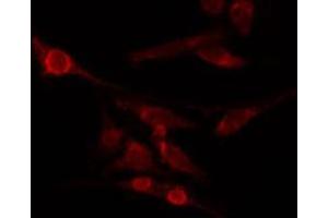 ABIN6274032 staining HepG2 by IF/ICC. (HSF1 anticorps  (pSer326))