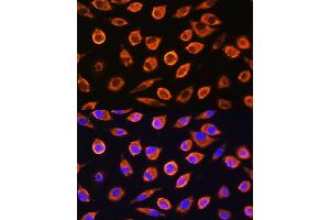 Immunofluorescence analysis of L929 cells using RND1 Rabbit pAb (ABIN6128639, ABIN6146997, ABIN6146998 and ABIN6217798) at dilution of 1:100.