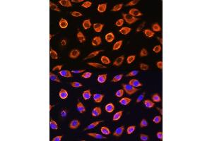 Immunofluorescence analysis of L929 cells using RND1 Rabbit pAb (ABIN6128639, ABIN6146997, ABIN6146998 and ABIN6217798) at dilution of 1:100. (RND1 anticorps  (AA 103-232))
