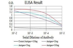 Black line: Control Antigen (100 ng),Purple line: Antigen (10 ng), Blue line: Antigen (50 ng), Red line:Antigen (100 ng) (P2RY1 anticorps)