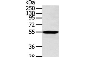 Western blot analysis of Human lung cancer tissue using ALDH2 Polyclonal Antibody at dilution of 1:300 (ALDH2 anticorps)