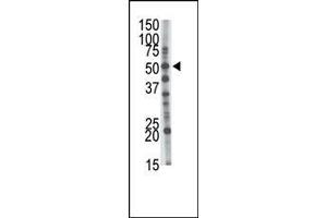 The anti-GCNT1 Pab (ABIN389033 and ABIN2839248) is used in Western blot to detect GCNT1 in mouse kidney tissue lysate. (GCNT1 anticorps  (AA 88-117))