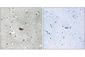 Immunohistochemistry analysis of paraffin-embedded human brain tissue, using PKC delta (Ab-645) Antibody. (PKC delta anticorps  (AA 612-661))
