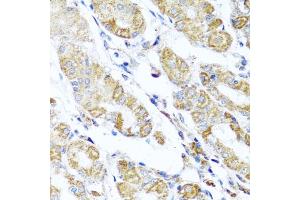 Immunohistochemistry of paraffin-embedded human stomach using D antibody (ABIN6127461, ABIN6139409, ABIN6139410 and ABIN6223779) at dilution of 1:100 (40x lens). (DARS2 anticorps  (AA 406-645))