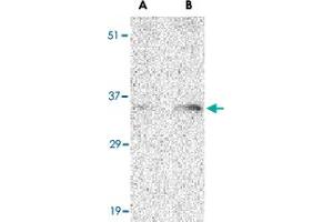 Western blot analysis of BAG1 in PC-3 cell lysate with BAG1 polyclonal antibody  at (A) 1 and (B) 2 ug/mL . (BAG1 anticorps  (N-Term))