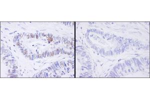 Immunohistochemistry (IHC) image for anti-Minichromosome Maintenance Complex Component 2 (MCM2) (pSer41) antibody (ABIN7448648) (MCM2 anticorps  (pSer41))