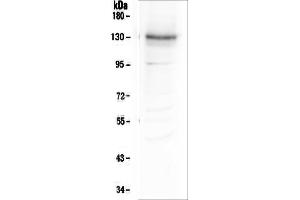Western blot analysis of Integrin alpha 3 using anti-Integrin alpha 3 antibody (ABIN6719410). (ITGA3 anticorps)