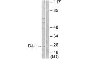 Western blot analysis of extracts from HuvEc cells, using DJ-1 Antibody.