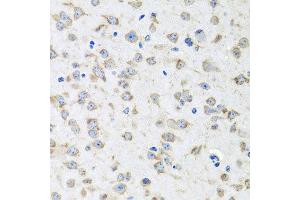 Immunohistochemistry of paraffin-embedded mouse brain using RPLP1 antibody at dilution of 1:100 (x40 lens). (RPLP1 anticorps)