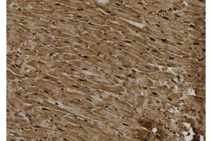 ABIN6277093 at 1/100 staining Rat heart tissue by IHC-P. (PKC epsilon anticorps  (C-Term))