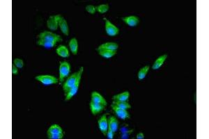 Immunofluorescent analysis of HepG2 cells using ABIN7167064 at dilution of 1:100 and Alexa Fluor 488-congugated AffiniPure Goat Anti-Rabbit IgG(H+L) (RFTN2 anticorps  (AA 1-300))