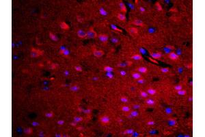 Formalin-fixed and paraffin embedded rat brain labeled with Rabbit Anti-RASAL1 Polyclonal Antibody, Unconjugated (ABIN762251) at 1:200 followed by conjugation to the secondary antibody Goat Anti-Rabbit IgG, Cy3 conjugated used at 1:200 dilution for 40 minutes at 37°C. (RASAL1 anticorps  (AA 451-550))
