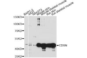 Western blot analysis of extracts of various cell lines, using CDSN antibody. (Corneodesmosin anticorps)