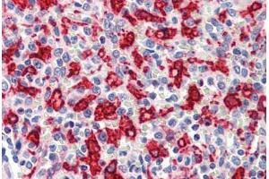 Human Spleen (formalin-fixed, paraffin-embedded) stained with HMOX1 antibody ABIN462109 at 10 ug/ml followed by biotinylated goat anti-rabbit IgG secondary antibody ABIN481713, alkaline phosphatase-streptavidin and chromogen.