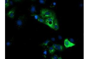 Anti-HP mouse monoclonal antibody (ABIN2453134) immunofluorescent staining of COS7 cells transiently transfected by pCMV6-ENTRY HP (RC223612). (Haptoglobin anticorps)