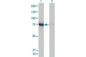 Western Blot analysis of DNM1L expression in transfected 293T cell line by DNM1L monoclonal antibody (M01), clone 3B5.